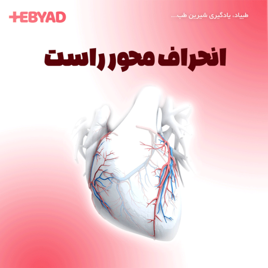 انحراف محور راست