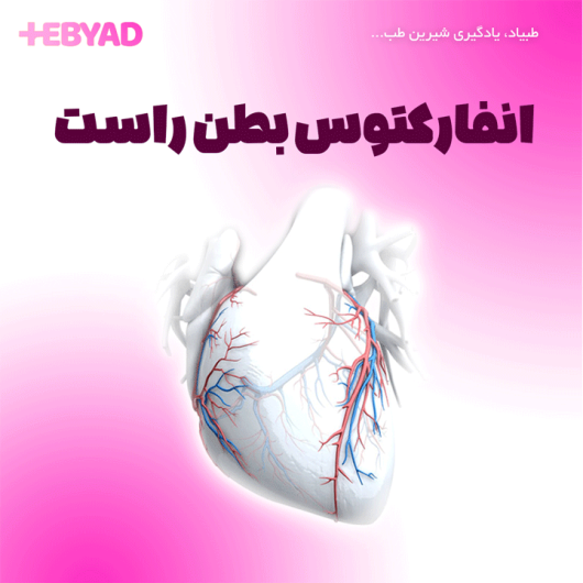 انفارکتوس بطن راست
