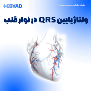 ولتاژ پایین QRS در نوار قلب