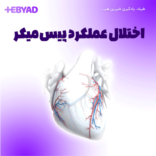 اختلال عملکرد پیس‌میکر