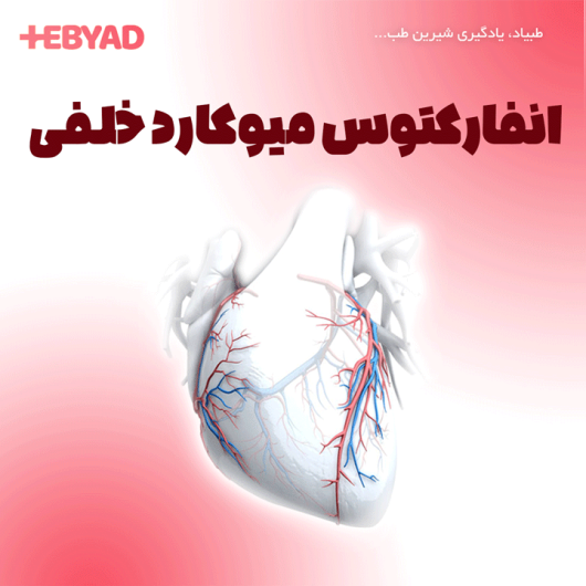 انفارکتوس میوکارد خلفی