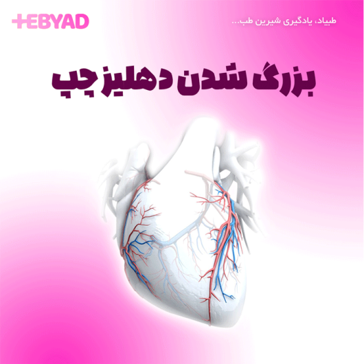 بزرگ شدن دهلیز چپ