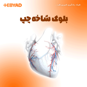 بلوک شاخه چپ