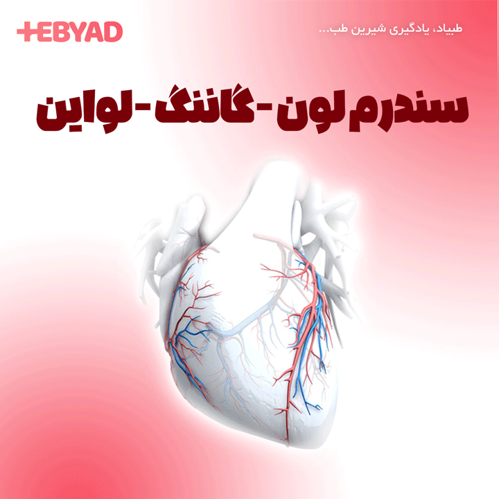 سندرم لون گاننگ لواین