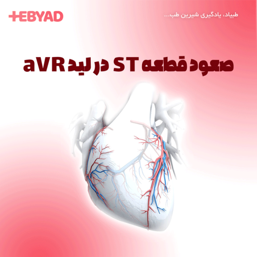 صعود قطعه ST در لید aVR