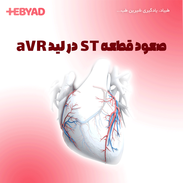 صعود قطعه ST در لید aVR