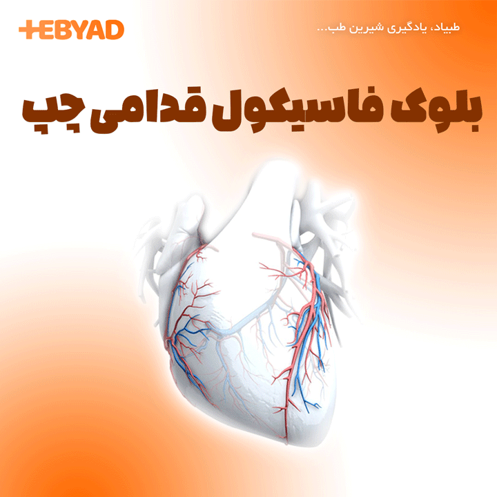 بلوک فاسیكول قدامی چپ