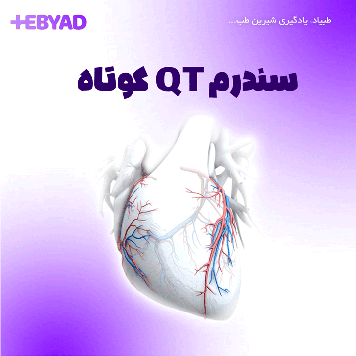 سندرم QT کوتاه