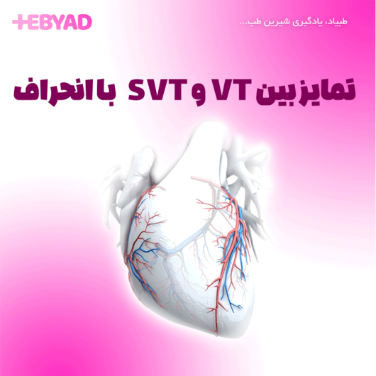 تمایز بین VT و SVT با انحراف