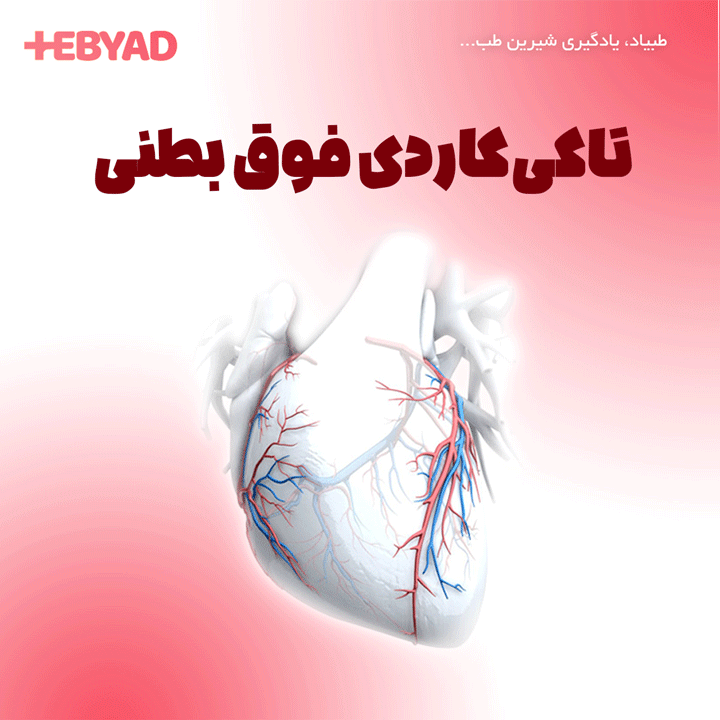 تاکی‌کاردی فوق بطنی